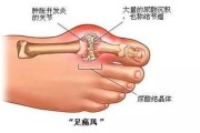 全了！各年龄段血压、血糖、血脂、尿酸对照表，快转给家人一份！