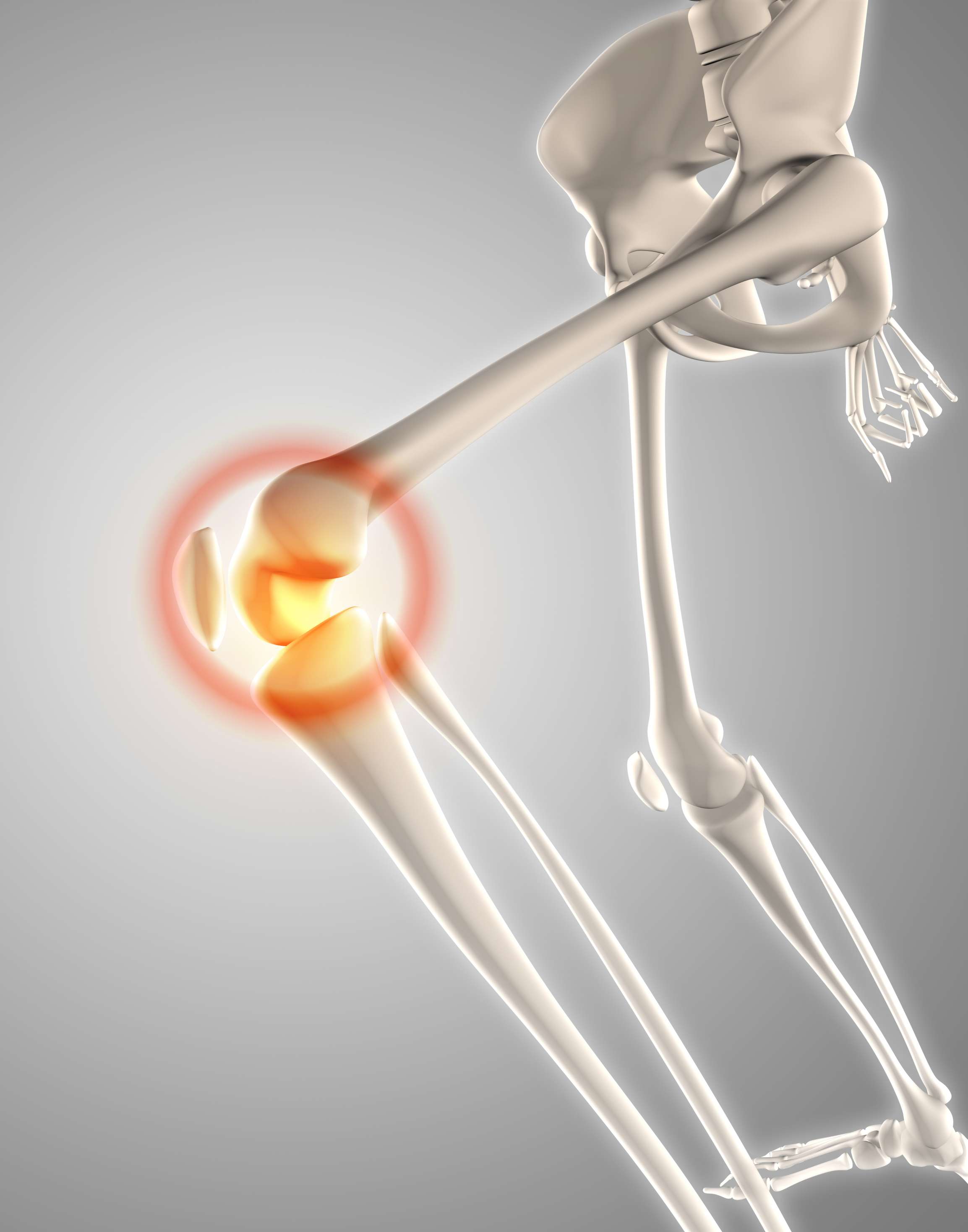 3d-skeleton-knee-pain.jpg