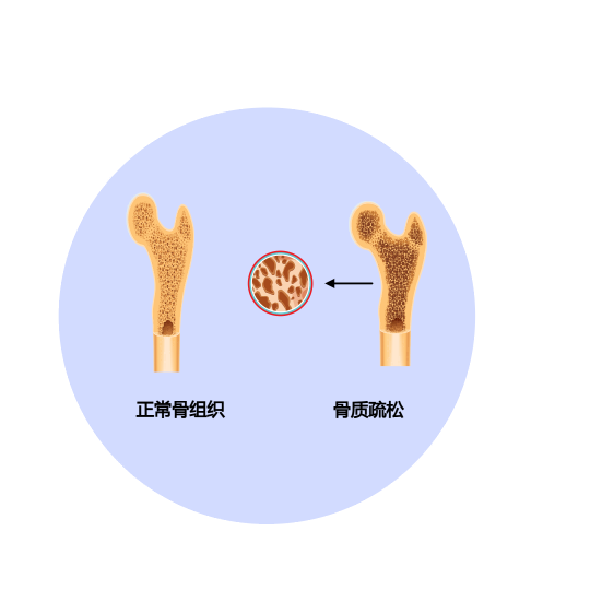 冬日补钙“秘籍”，助你养出好身体